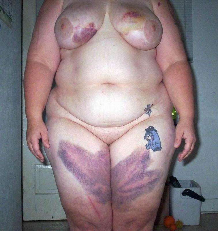 16P extremely bondaged boobs and pussies