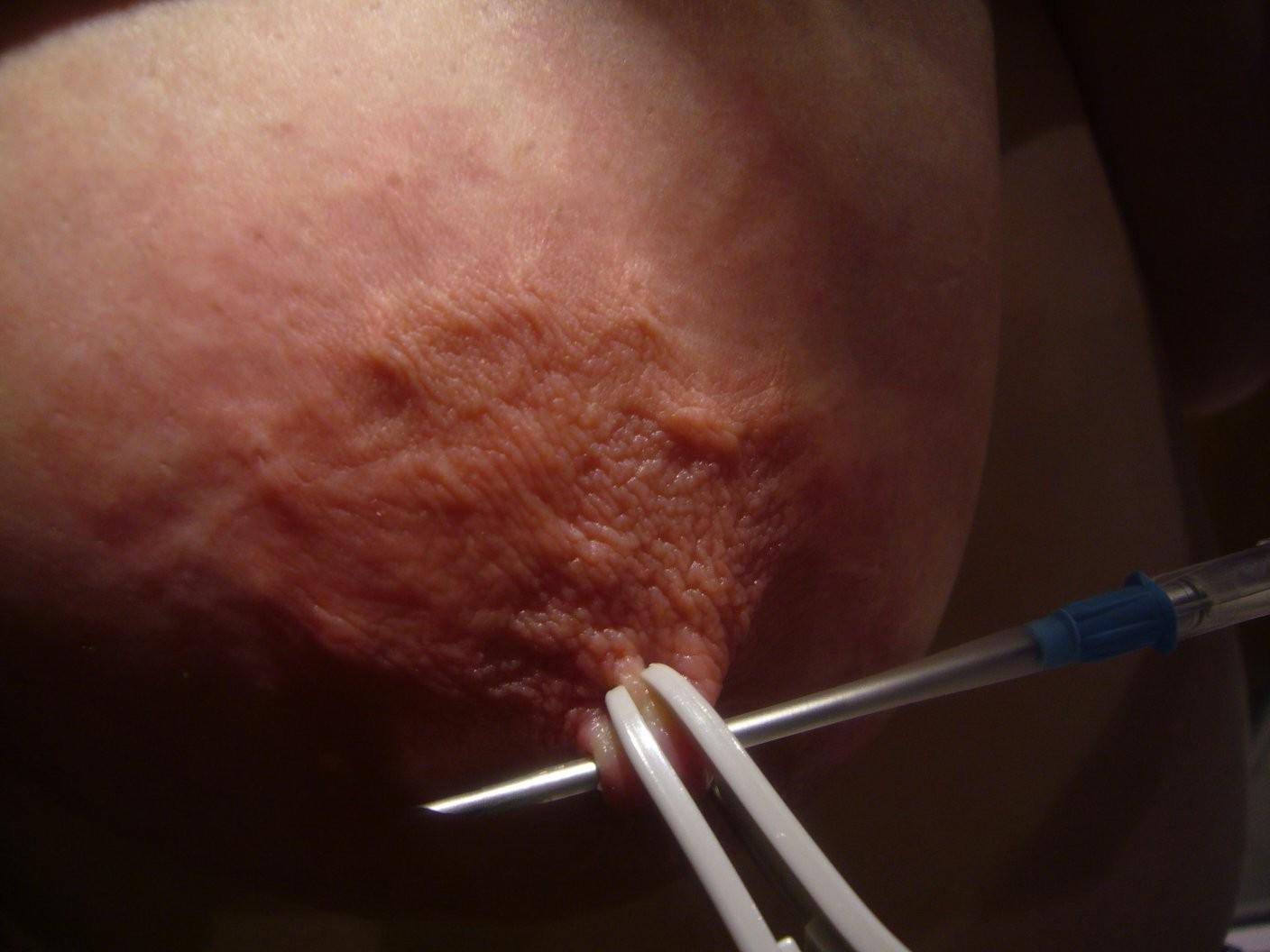 12P Urethral Play