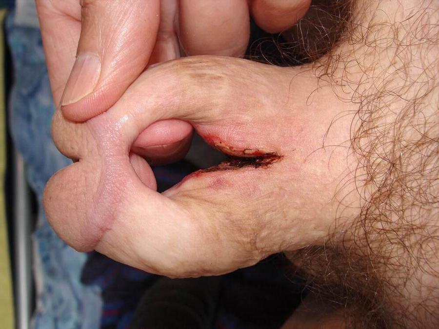 11P Very extremely weird cocks