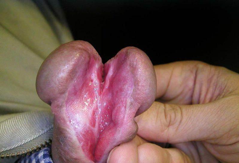 11P Very extremely weird cocks