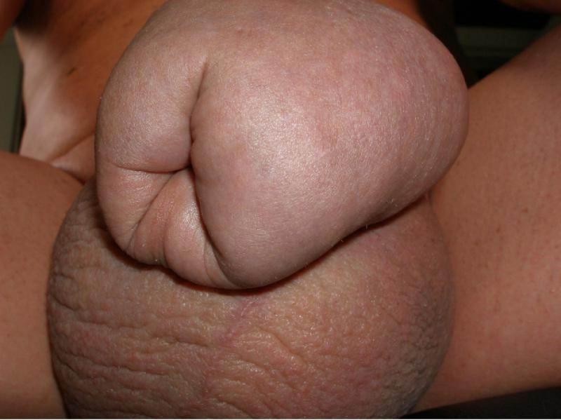 11P Very extremely weird cocks