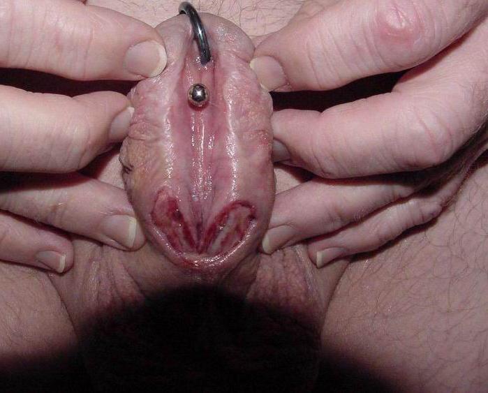 11P Extremely weird cocks