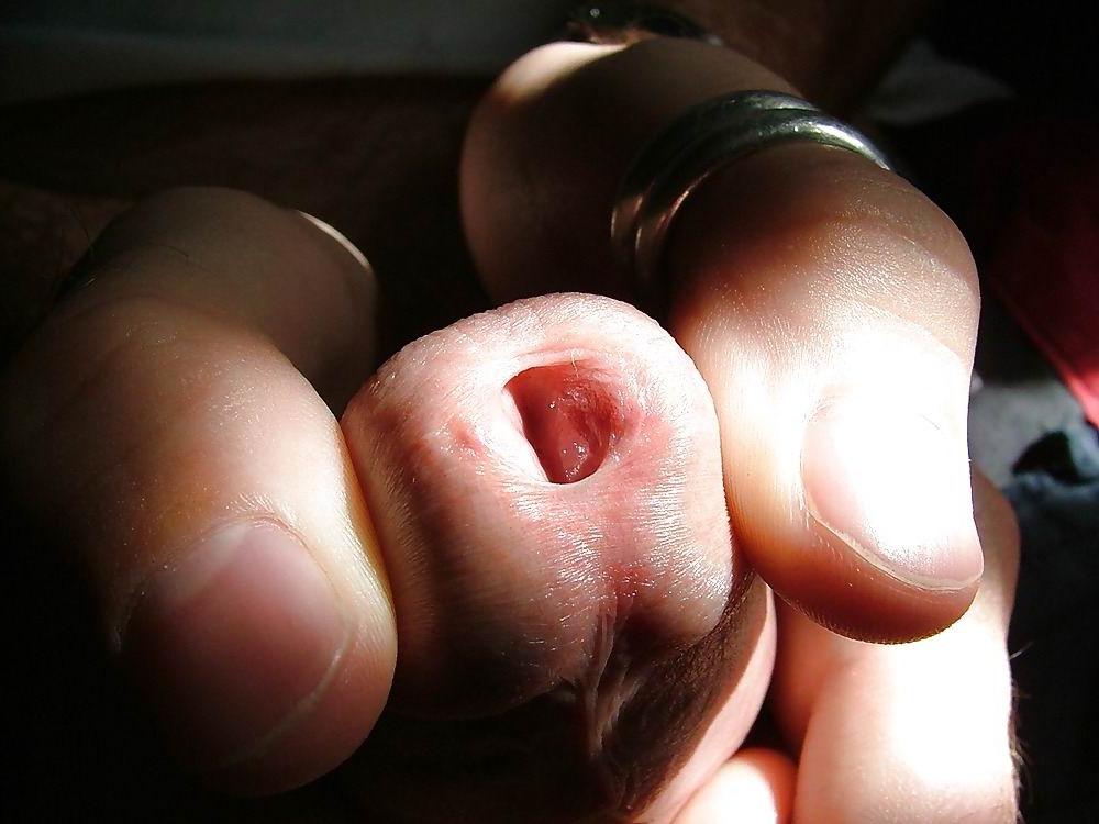 18P Extrem Peniseinfügungen