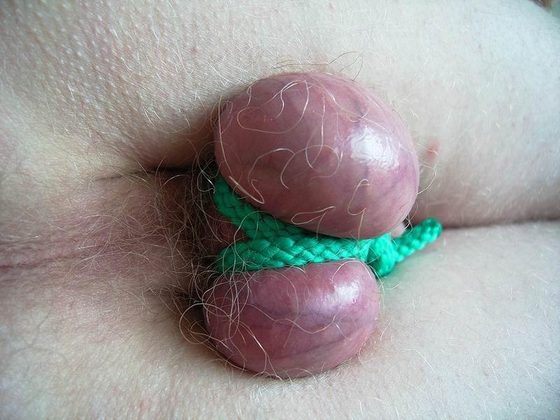 18P extremely tortured dicks