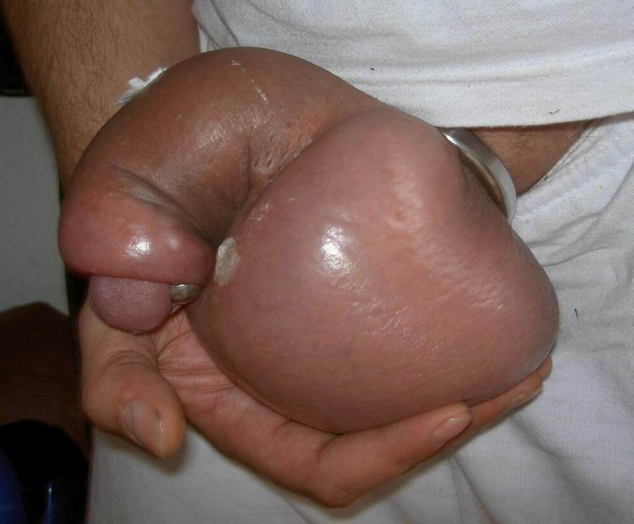 17P extremely tortured dicks