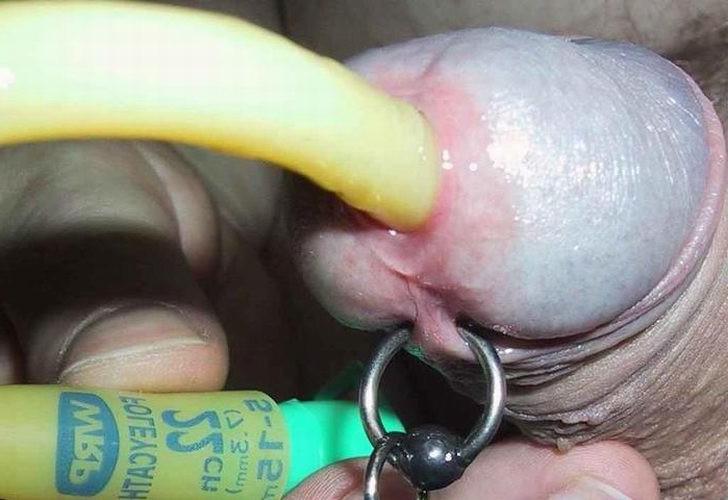 18P Extremely Object Insertions In Penis
