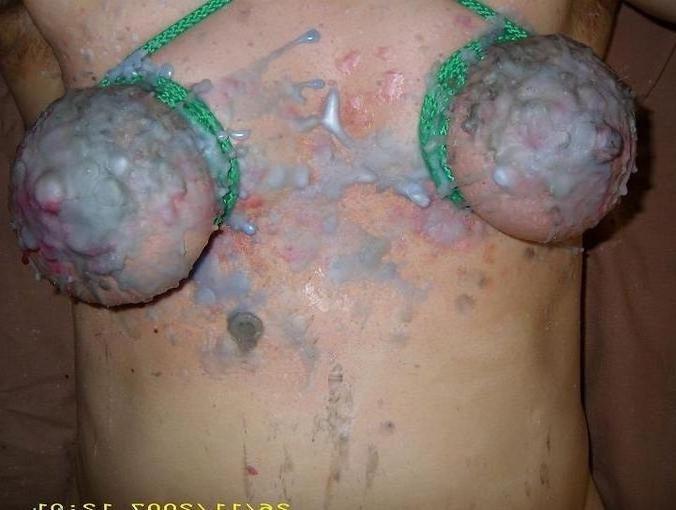 20P extremely cruel tortured tits and cocks