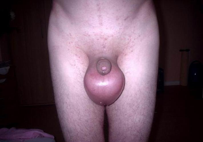 18P Extremely Insertions In Penis