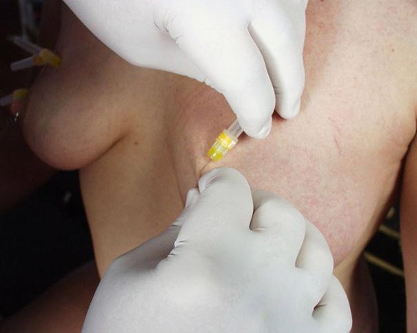 16P Master and submissive play with needles
