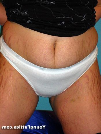 15P Plump chubby posing and getting naked