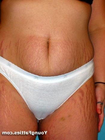 15P Plump chubby posing and getting naked