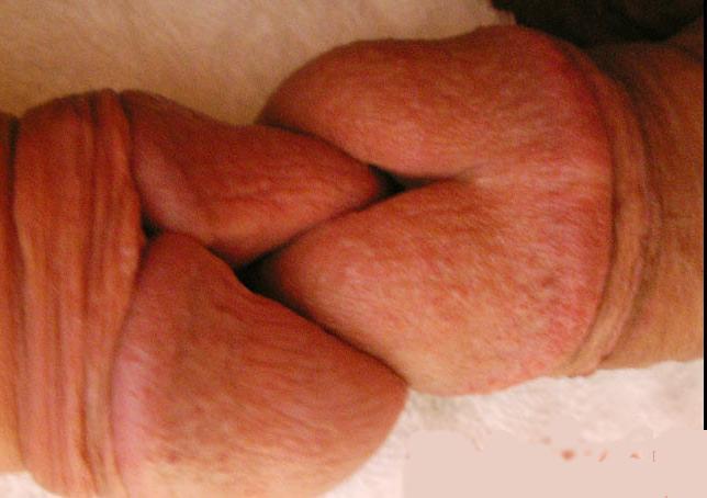 12P Urethral Play