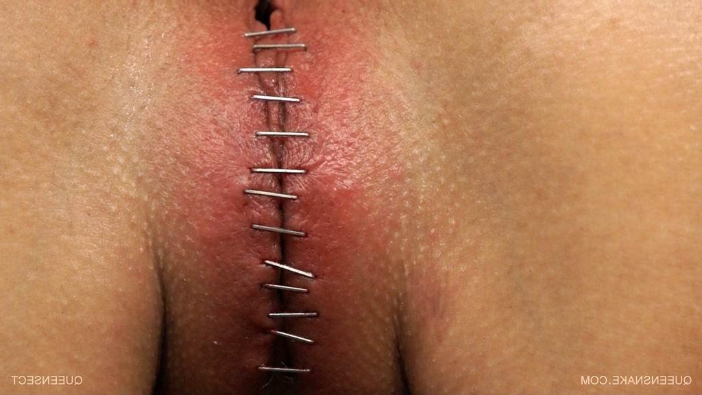 15P extreme bizarre pussy insertions
