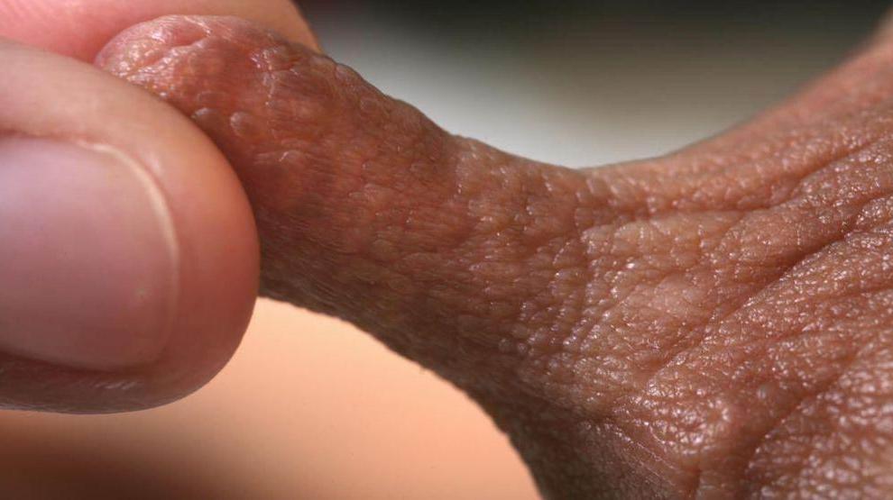 15P real huge nipples and areolas