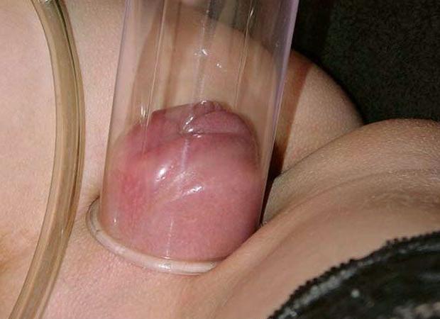 14P Extreme vacuum pumps and swollen pussy lips