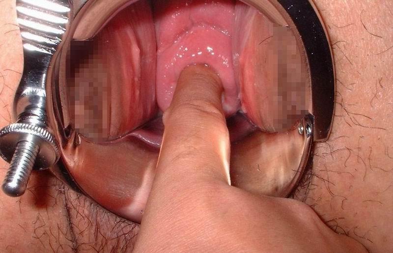 16P extreme gaping twats and speculum insertions