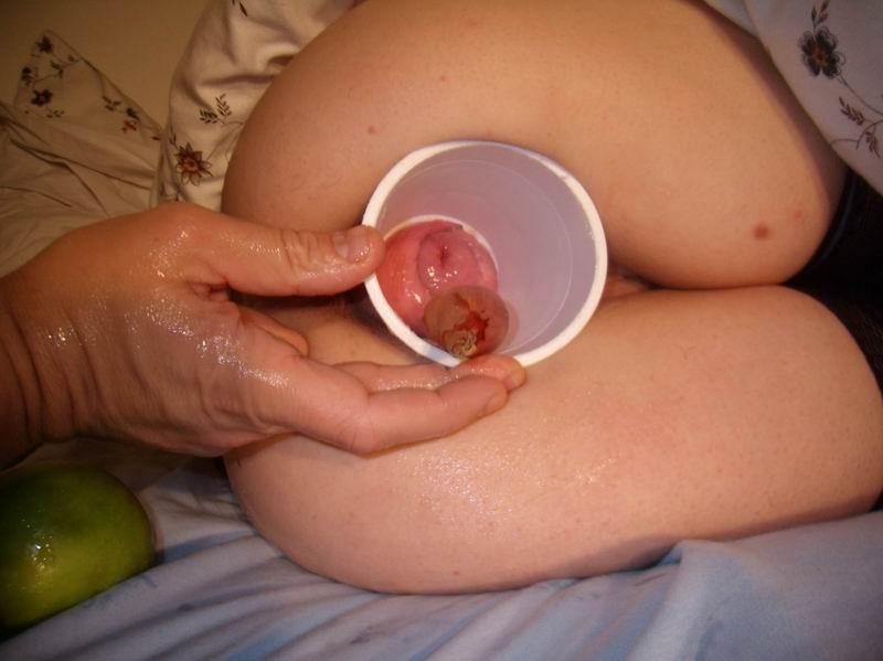 12P extreme homemade vaginal and anal insertions
