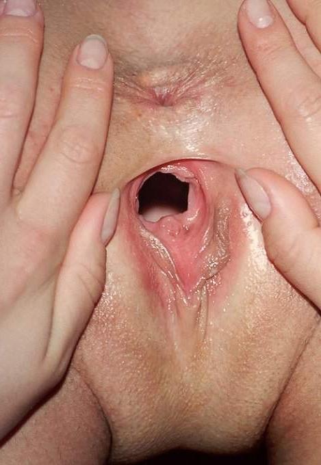 15P extreme homemade fisting and object insertions
