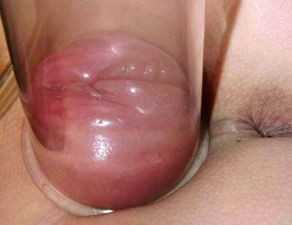 11P big and swollen amateur pussies after pumping