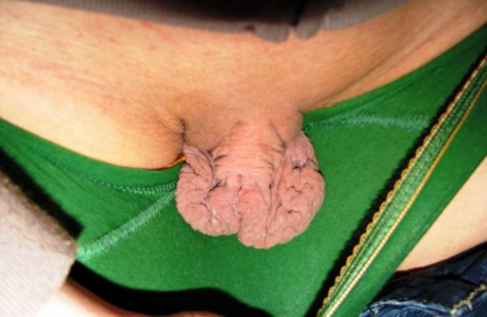 15P very huge pussylips and clitoris