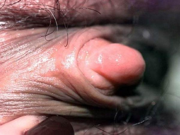 16P huge swollen meaty clits close ups