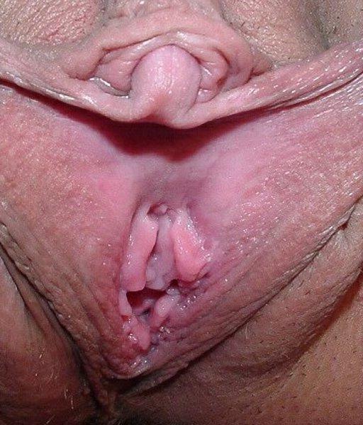 16P huge swollen meaty clits close ups
