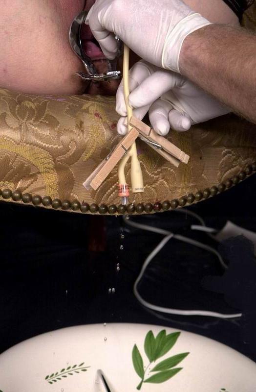 13P fetish couple bizarre speculum games
