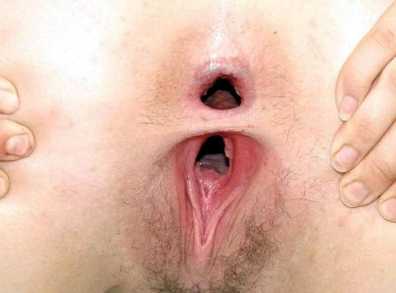 15P extreme pussy insertions and fisting