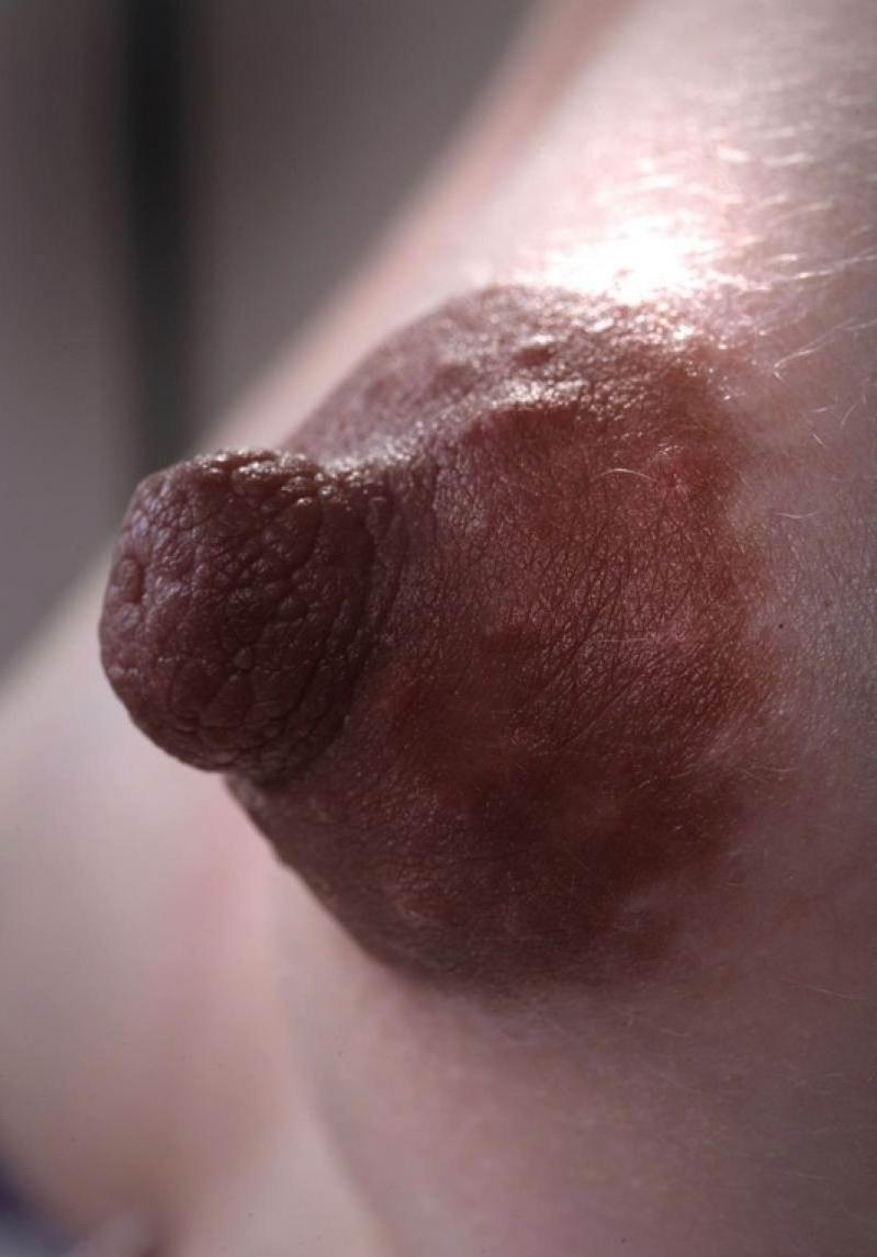 16P real huge nipples and areolas