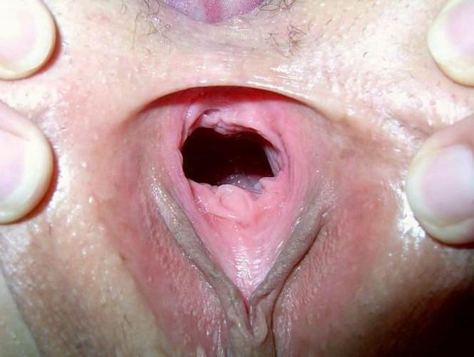 16P very extremely gaping pussies