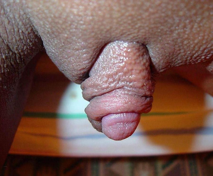 15P Real huge clits