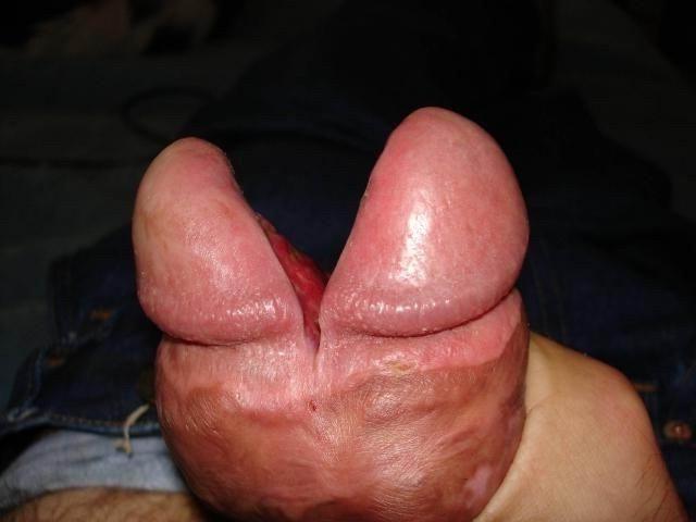 12P Weird cocks