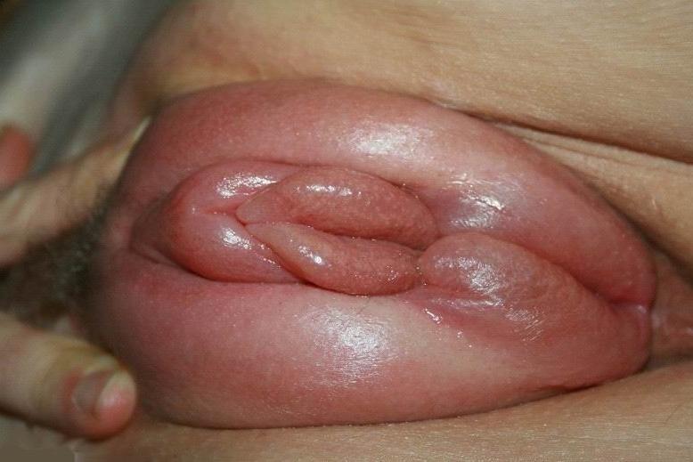19P Extreme pumping