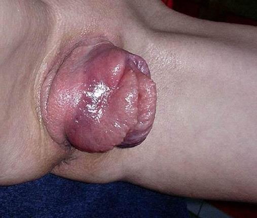 19P Extreme pumping