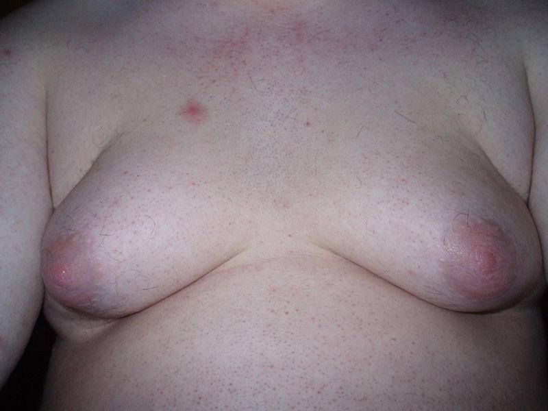16P Ugly, weird shaped boobs