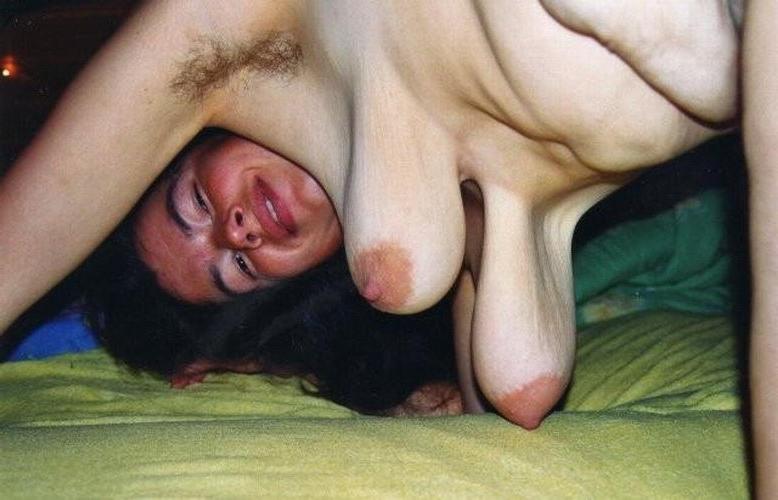 16P Ugly  weird shaped boobs