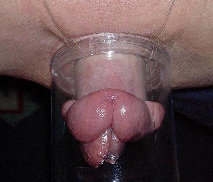 15P Real Huge Clitoris