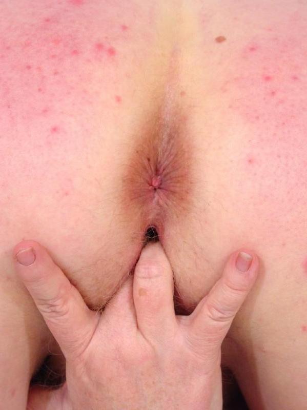 20P Huge mature fat woman