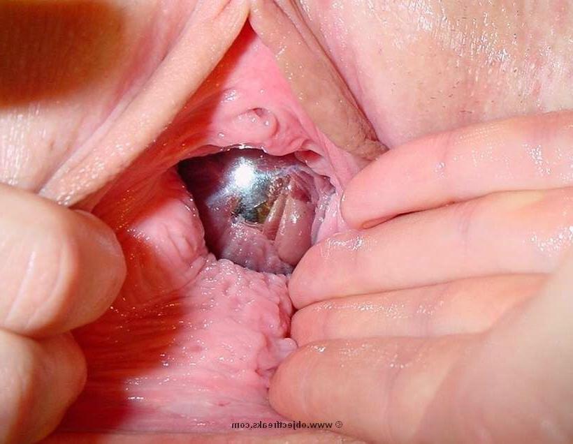 16P bizarre object insertion and fisting