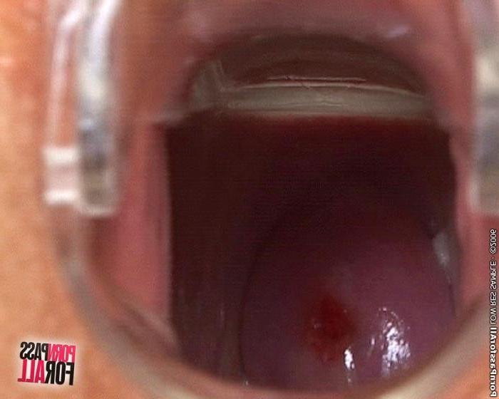 15P Nasty girl in hot pussy fingering, dildoing and speculum playing