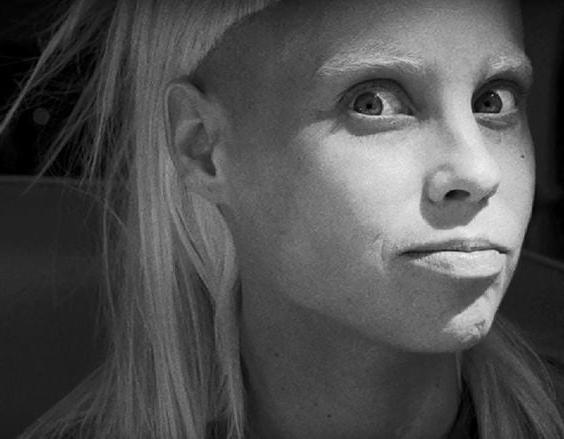 25P cute Yolandi Visser