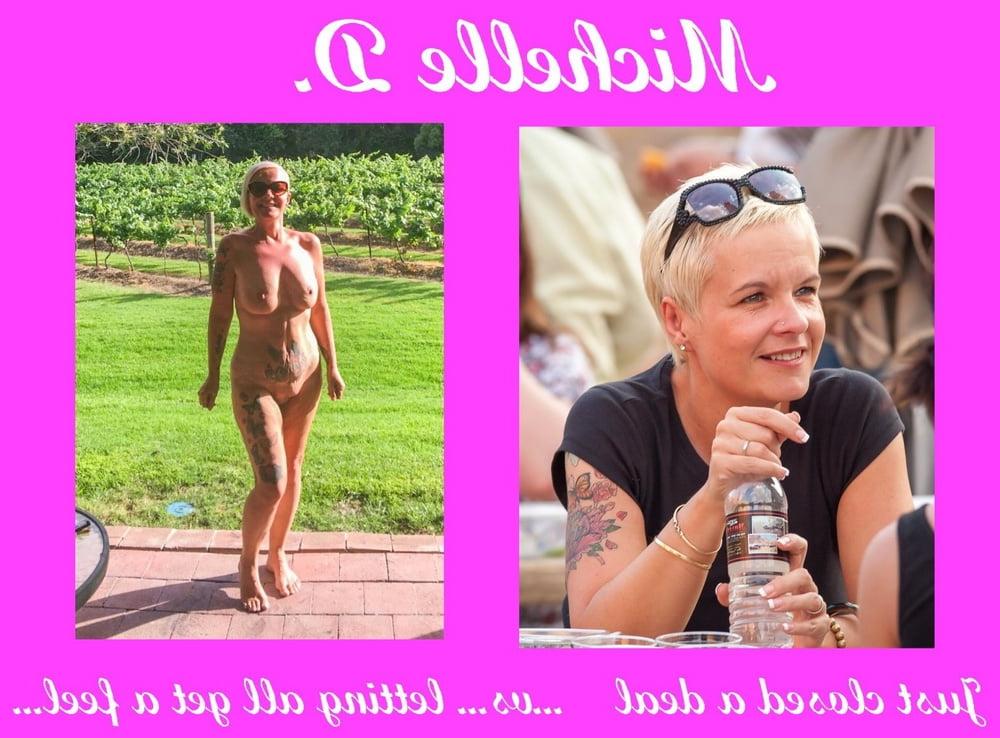 25P British slut Michelle after boob job