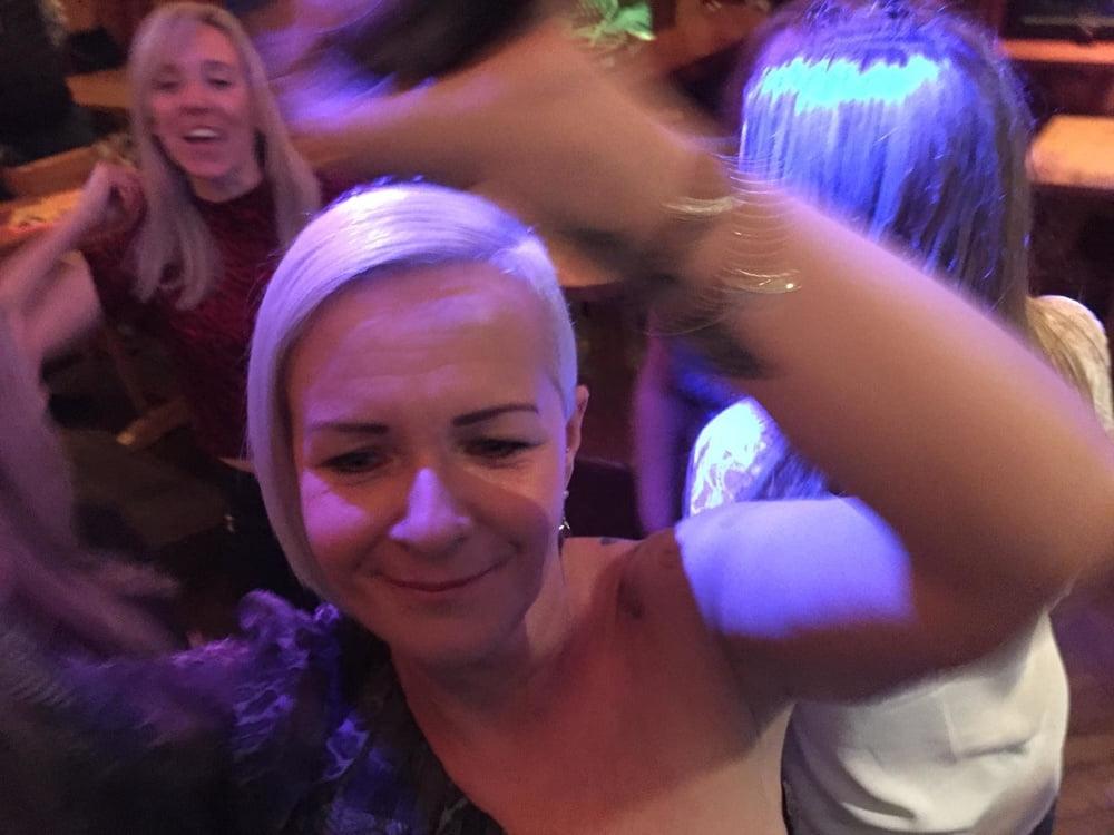25P British slut Michelle after boob job