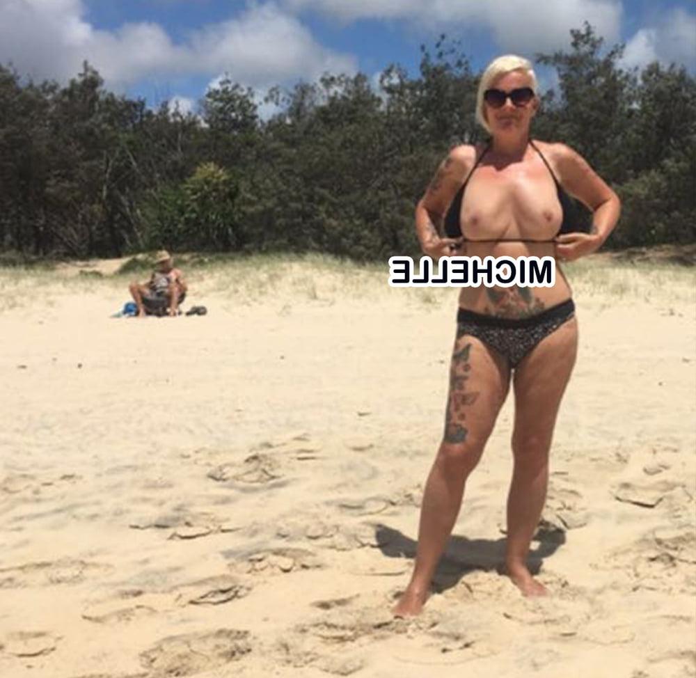 25P British slut Michelle after boob job