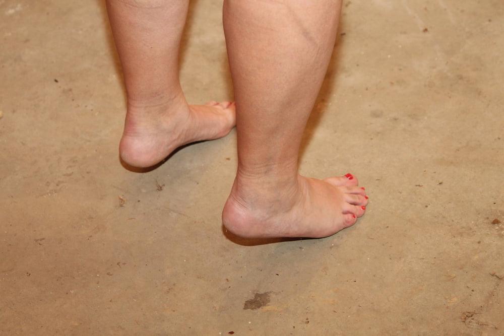 25P Feet photos