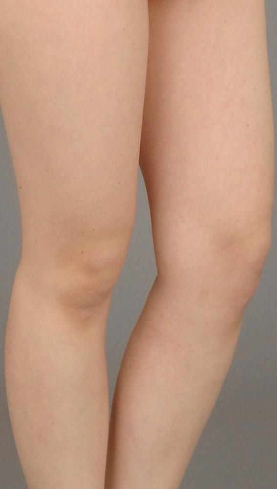 25P Feet ( ASUKA ) 2