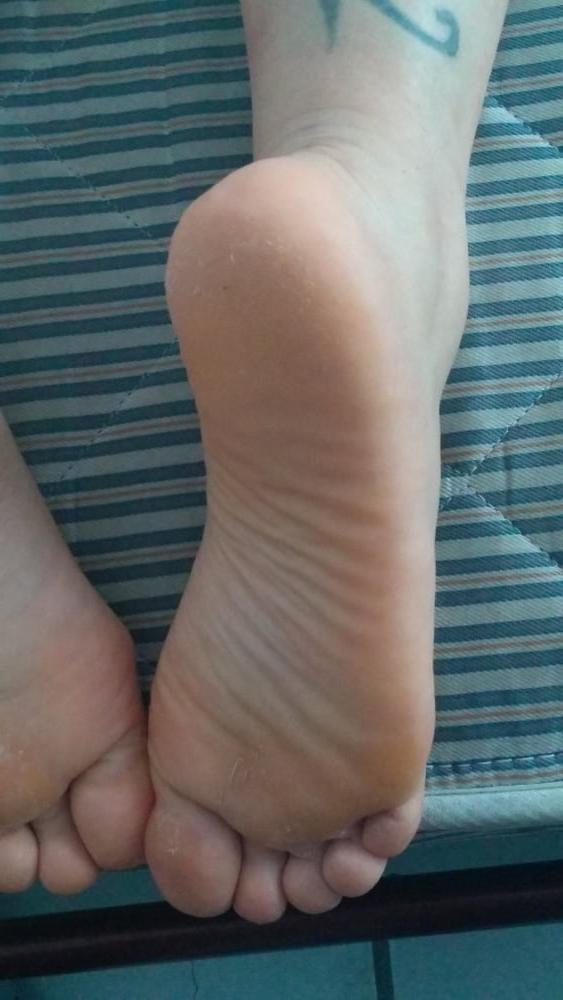 13P Rough heels and feet soles