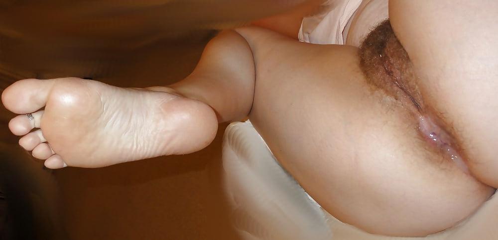 13P Rough heels and feet soles