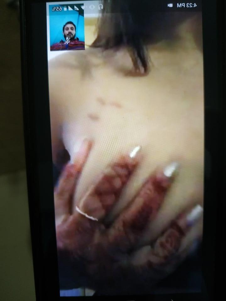 25P Bangladeshi Cute Girl Video Calling Nude Leaked from Boy