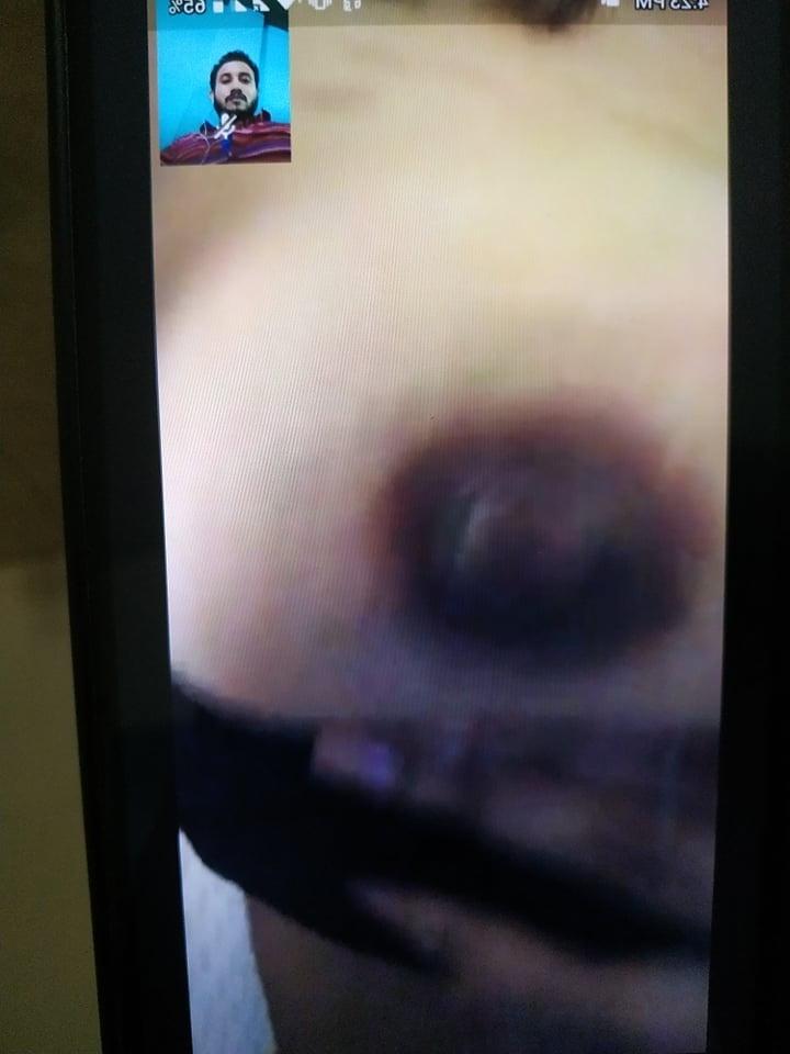 25P Bangladeshi Cute Girl Video Calling Nude Leaked from Boy